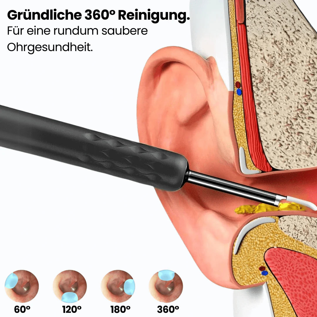 Nanoear