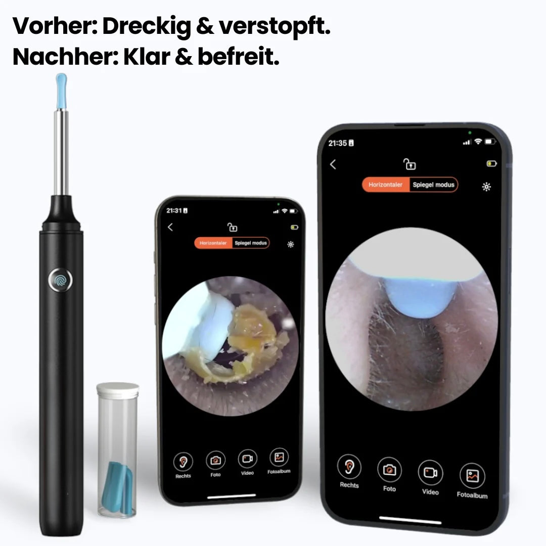 Nanoear