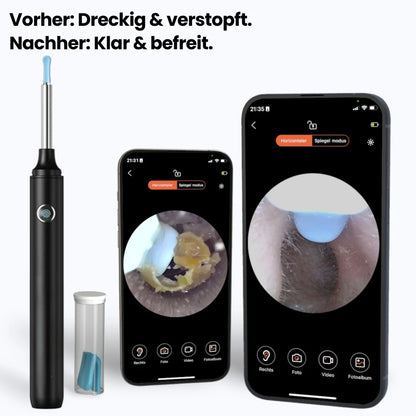Nanoear